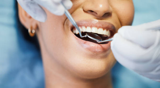 Best Affordable Emergency Dental Care  in Los Fresnos, TX